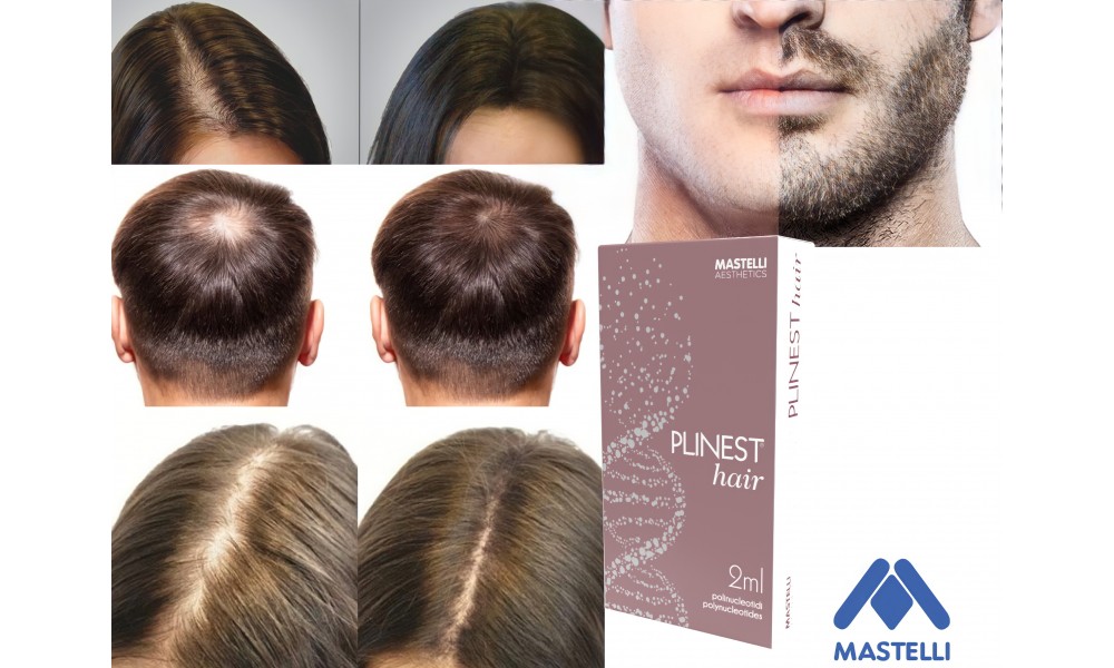 ПОЛИНУКЛЕОТИДЫ «MASTELLI PLINEST HAIR»