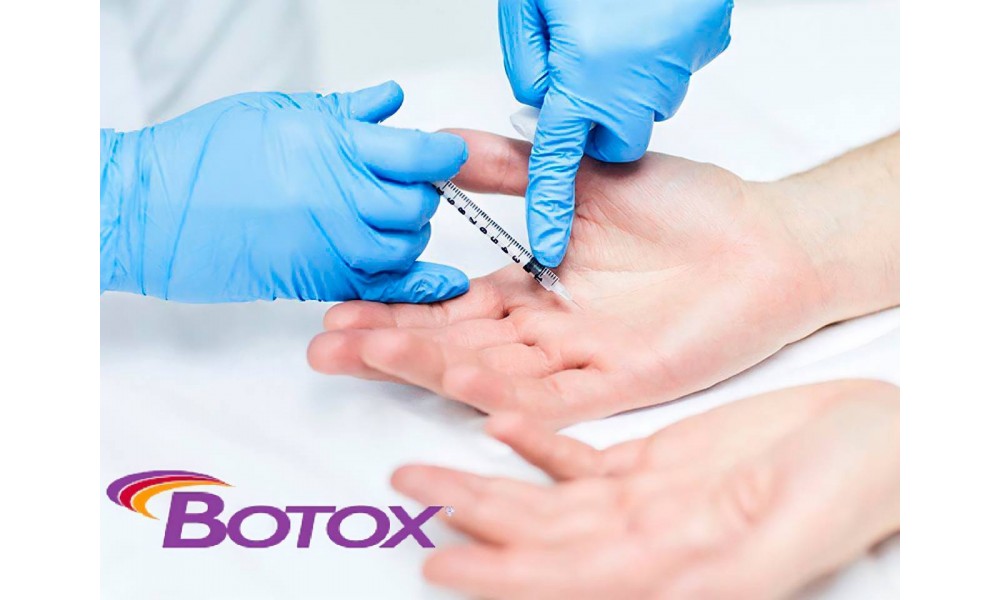 БОТУЛИНОТЕРАПИЯ ЛАДОНЕЙ (Botox)