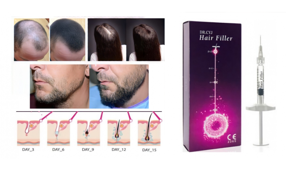 МЕЗОТЕРАПЕВТИЧЕСКИЙ КОКТЕЙЛЬ «DR. CYJ HAIR FILLER»